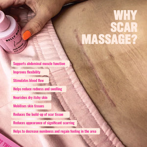 Viva La Vulva - Belly Birth Scar Oil - Urban Naturals