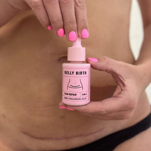 Viva La Vulva - Belly Birth Scar Oil - Urban Naturals