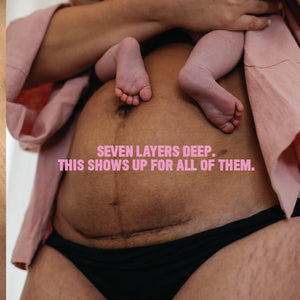 Viva La Vulva - Belly Birth Scar Oil - Urban Naturals