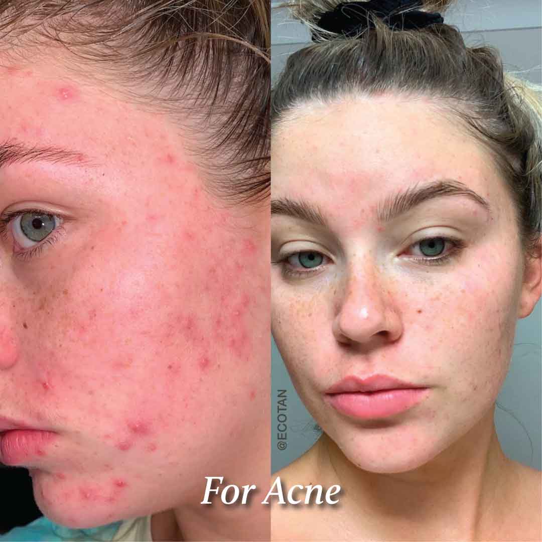 Glory Oil - Urban Naturals